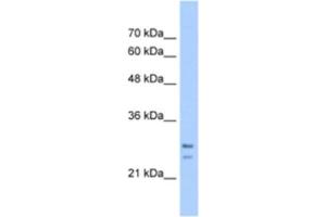 Western Blotting (WB) image for anti-Signal Recognition Particle Receptor, B Subunit (SRPRB) antibody (ABIN2463283) (SRPRB antibody)