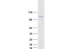 Validation with Western Blot (RIOK1 Protein (Transcript Variant 1) (Myc-DYKDDDDK Tag))