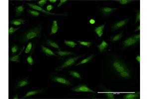 Immunofluorescence of monoclonal antibody to PRKCD on HeLa cell. (PKC delta antibody  (AA 577-676))