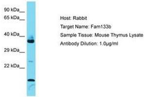 Image no. 1 for anti-Family with Sequence Similarity 133, Member B (FAM133B) (AA 101-150) antibody (ABIN6750343) (FAM133B antibody  (AA 101-150))