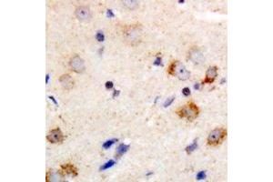 Immunohistochemical analysis of PKC theta staining in human brain formalin fixed paraffin embedded tissue section.