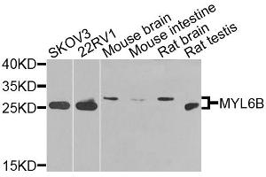 Western blot analysis of extracts of various cell lines, using MYL6B antibody. (MYL6B antibody)