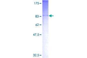 ASB2 Protein (AA 1-587) (GST tag)