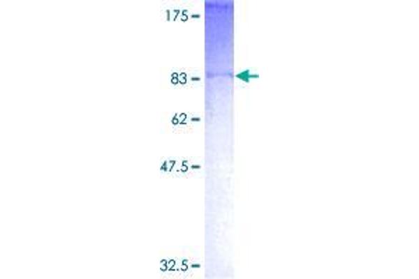 ASB2 Protein (AA 1-587) (GST tag)