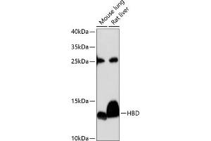 Western blot analysis of extracts of various cell lines, using HBD antibody (ABIN6132879, ABIN6141642, ABIN6141643 and ABIN6224938) at 1:3000 dilution. (HBd antibody  (AA 1-147))