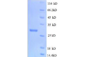 SDS-PAGE (SDS) image for Colony Stimulating Factor 1 (Macrophage) (CSF1) (AA 33-262), (partial) protein (His tag) (ABIN5712546)