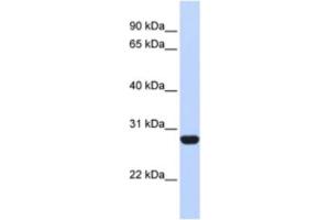 Western Blotting (WB) image for anti-Ribosomal Protein L13 (RPL13) antibody (ABIN2462055)