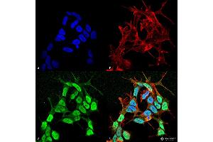 Immunocytochemistry/Immunofluorescence analysis using Mouse Anti-Nav beta 3 Monoclonal Antibody, Clone S396-29 . (SCN3B antibody  (AA 1-215) (FITC))