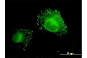 anti-Amine Oxidase, Copper Containing 3 (Vascular Adhesion Protein 1) (AOC3) (AA 351-450) antibody