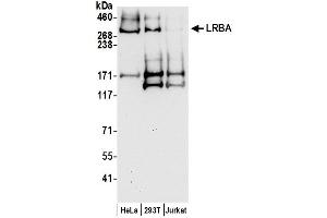anti-LPS-Responsive Vesicle Trafficking, Beach and Anchor Containing (LRBA) (AA 1125-1175) antibody