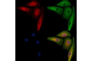 ABIN6259719 and ABIN6279066 staining  cells by IF/ICC. (ACBD5 antibody  (Internal Region))