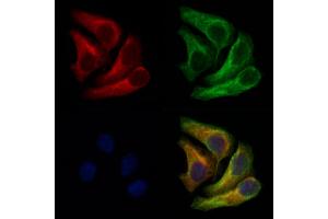ABIN6262730 and ABIN6266734 staining Hela cells by IF/ICC. (Adenylate Kinase 1 antibody  (Internal Region))
