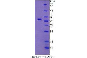 Image no. 1 for Sorting Nexin 13 (SNX13) (AA 97-284) protein (His tag) (ABIN6236841)
