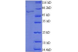 STARD7 Protein (AA 61-307, partial) (GST tag)
