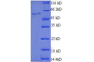 StAR-Related Lipid Transfer (START) Domain Containing 7 (STARD7) (AA 61-307), (partial) protein (GST tag) (STARD7 Protein (AA 61-307, partial) (GST tag))