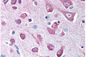 Brain, cortex (Serotonin Receptor 3A antibody  (N-Term))