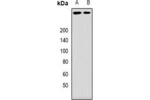 Western blot analysis of ANKHD1 expression in mouse brain (A), rat brain (B) whole cell lysates. (ANKHD1 antibody)