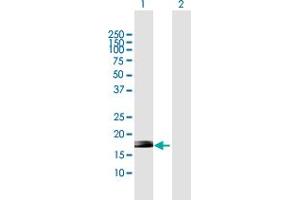 Western Blot analysis of ZNF576 expression in transfected 293T cell line by ZNF576 MaxPab polyclonal antibody.