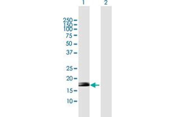 ZNF576 Antikörper  (AA 1-170)