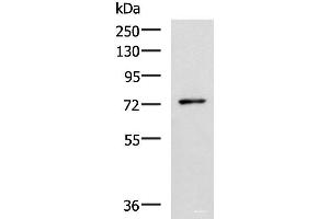 Western blot analysis of Mouse thymus tissue lysate using L3MBTL2 Polyclonal Antibody at dilution of 1:1000 (L3MBTL2 antibody)