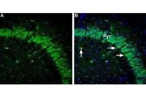 Expression of GABRA5 in mouse brain - Immunohistochemical staining of mouse hippocampus sections using Anti-GABA(A) α5 Receptor Antibody (ABIN7043189, ABIN7044317 and ABIN7044318), (1,600). (GABRA5 antibody  (2nd Cytoplasmic Loop))
