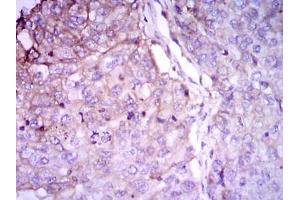 Immunohistochemistry (IHC) image for anti-RAB4A, Member RAS Oncogene Family (RAB4A) antibody (ABIN1108812) (Rab4 antibody)