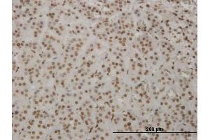 Immunoperoxidase of monoclonal antibody to HMX2 on formalin-fixed paraffin-embedded human adrenal gland. (HMX2 antibody  (AA 125-224))