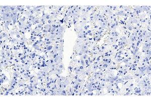 ABIN5855385 Negative Control showing staining of paraffin embedded Human Lung, with no primary antibody. (SLC18A2 antibody)