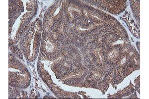 Image no. 1 for anti-V-Ets Erythroblastosis Virus E26 Oncogene Homolog 2 (ETS2) (AA 90-349) antibody (ABIN1491702) (ETS2 antibody  (AA 90-349))