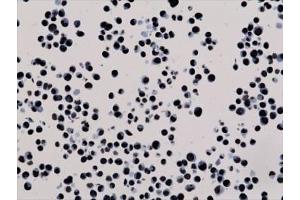 ICC testing of human HepG2 cells with recombinant H3K27me3 antibody. (Recombinant Histone 3 antibody  (H3K27me3))