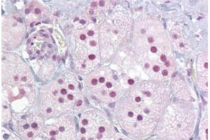 Immunohistochemistry (IHC) image for anti-Nuclear Receptor Subfamily 4, Group A, Member 1 (NR4A1) (AA 324-373) antibody (ABIN6748603)