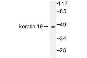 Image no. 1 for anti-Keratin 19 (KRT19) antibody (ABIN265499) (Cytokeratin 19 antibody)