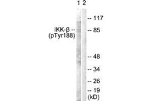 Western blot analysis of extracts from COS7 cells, using IKK-beta (Phospho-Tyr188) Antibody. (IKBKB antibody  (pTyr188))