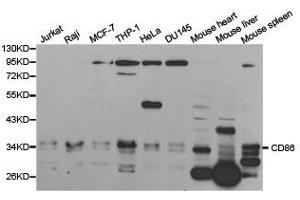 Western Blotting (WB) image for anti-CD86 (CD86) antibody (ABIN1871657) (CD86 antibody)