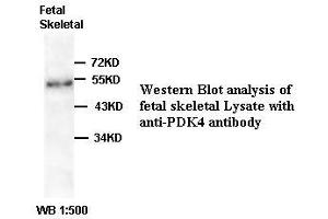 Image no. 2 for anti-Pyruvate Dehydrogenase Kinase, Isozyme 4 (PDK4) antibody (ABIN791131) (PDK4 antibody)