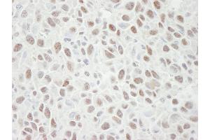 Immunohistochemistry (IHC) image for anti-Minichromosome Maintenance Deficient 4 (MCM4) (AA 750-800) antibody (ABIN7448654) (MCM4 antibody  (AA 750-800))
