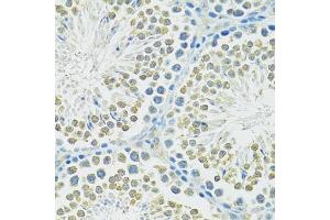 Immunohistochemistry of paraffin-embedded mouse testis using SLC1A4 antibody (ABIN6292419) at dilution of 1:100 (40x lens).