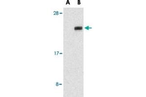 Western blot analysis of NGFRAP1 in human brain tissue lysates with NGFRAP1 polyclonal antibody  at 1 ug/mL in the presence (A) or absence (B) of blocking peptide. (Nerve Growth Factor Receptor (TNFRSF16) Associated Protein 1 (NGFRAP1) (Internal Region) antibody)
