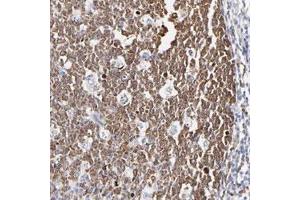 Immunohistochemical staining of human tonsil with NCAPH polyclonal antibody  shows cytoplasmic positivity in reaction center cells.