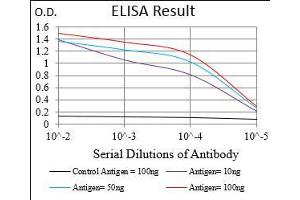 Black line: Control Antigen (100 ng), Purple line: Antigen(10 ng), Blue line: Antigen (50 ng), Red line: Antigen (100 ng), (CD36 antibody  (AA 30-130))