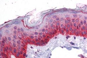 Human Skin: Formalin-Fixed, Paraffin-Embedded (FFPE) (BMP7 antibody  (AA 165-214))