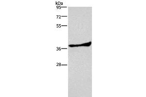 Western Blot analysis of Human fetal liver tissue using AMPK gamma1 Polyclonal Antibody at dilution of 1:300 (PRKAG1 antibody)