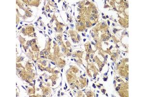 Immunohistochemistry of paraffin-embedded Human gastric using DGKE Polyclonal Antibody at dilution of 1:100 (40x lens). (DGKE antibody)