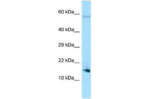 WB Suggested Anti-SPEM1 Antibody Titration: 1. (SPEM1 antibody  (N-Term))