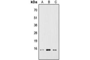 Western blot analysis of RPS19BP1 expression in HEK293T (A), Raw264. (RPS19BP1 antibody  (Center))