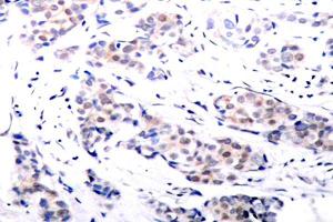 Image no. 2 for anti-ELK1, Member of ETS Oncogene Family (ELK1) antibody (ABIN265398) (ELK1 antibody)