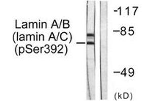 Western blot analysis of extracts from HeLa cells, using Lamin A/C (Phospho-Ser392) Antibody. (Lamin A/C antibody  (pSer392))