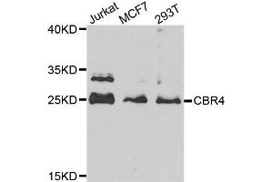 Western blot analysis of extract of various cells, using CBR4 antibody. (CBR4 antibody)