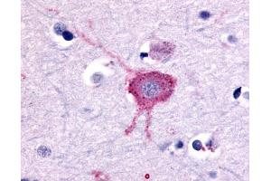 Anti-GRM2 / MGLUR2 antibody IHC of human brain, neurons and glia. (GRM2 antibody  (N-Term))