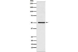 Western blot analysis of Cytochrome P450 17A1 expression in Jurkat cell lysate.